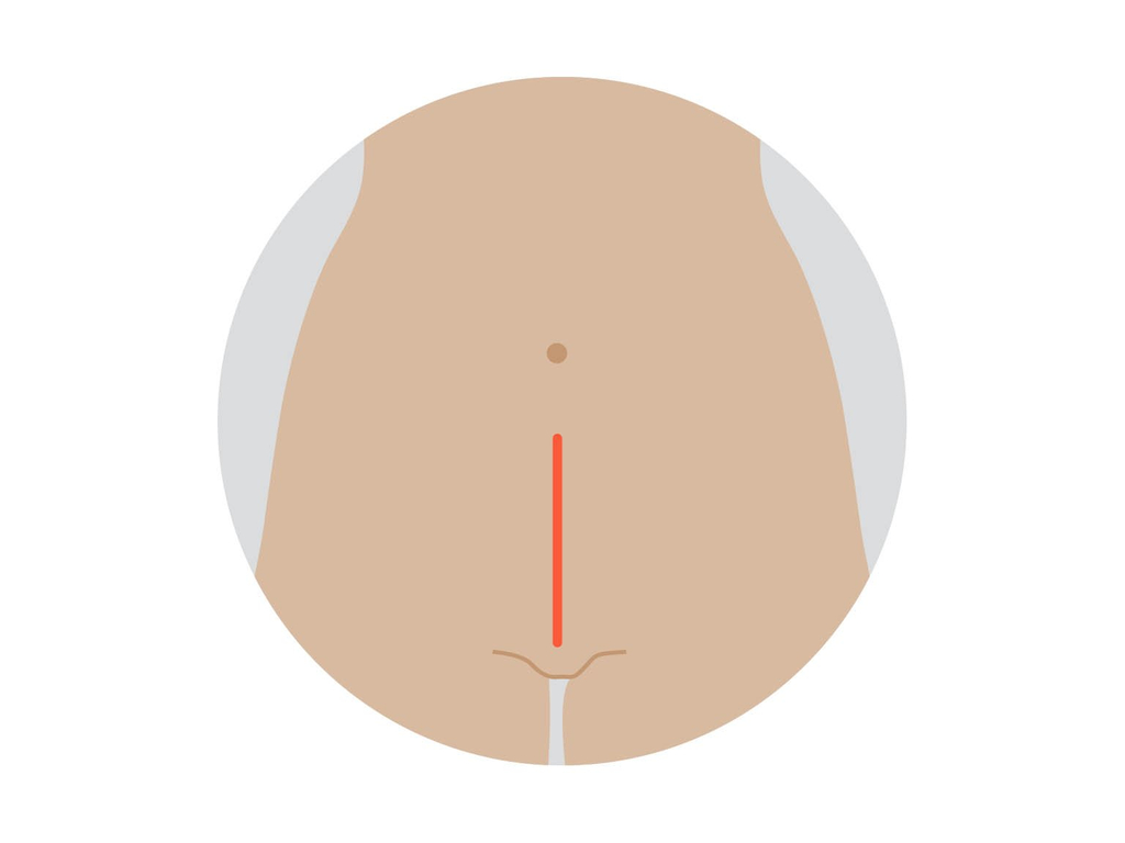 Open surgery section image