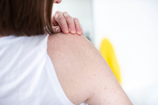 Check for signs of skin cancer image